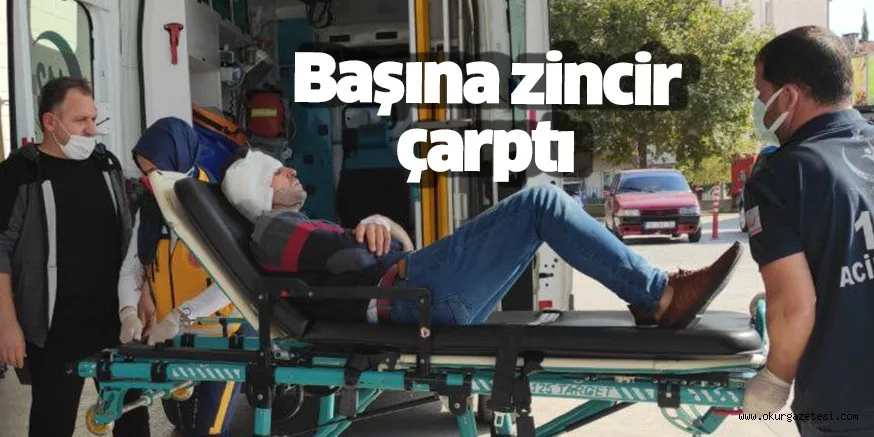 Başına zincir parçtı