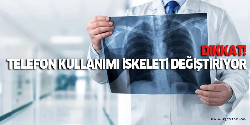 DiKKAT! TELEFON KULLANIMI iSKELETi DEĞiŞTiRiYOR