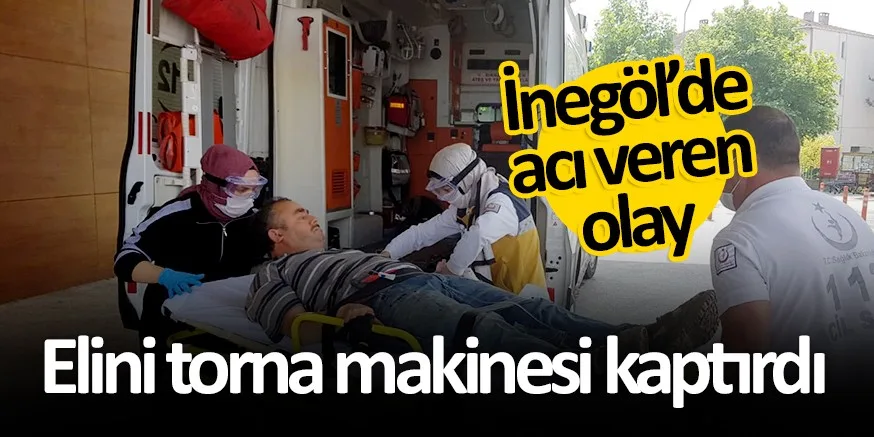 ELİNİ TORNA MAKİNESİ KAPTIRDI