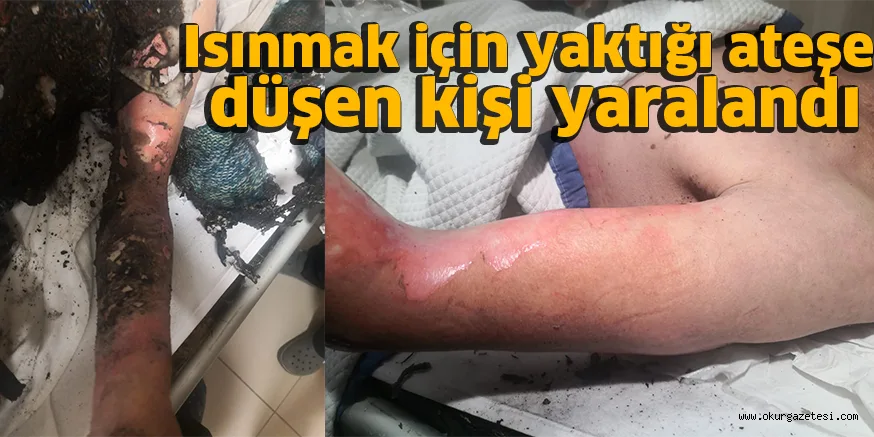 Isınmak için yaktığı ateşe düşen kişi yaralandı