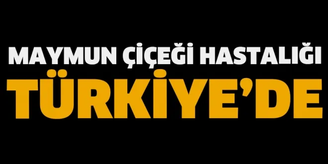 Son Dakika: Bakan Koca kötü haberi verdi! Türkiye'de ilk maymun çiçeği vakasına rastlandı