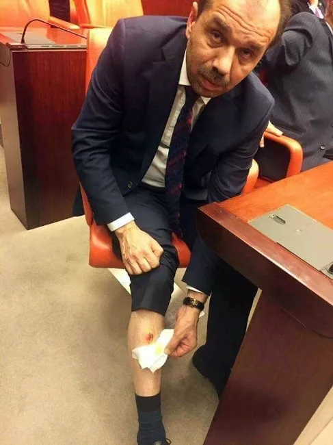 Tbmmde Chp Milletvekili, Ak Partili Baltayı Bacağından Isırdı